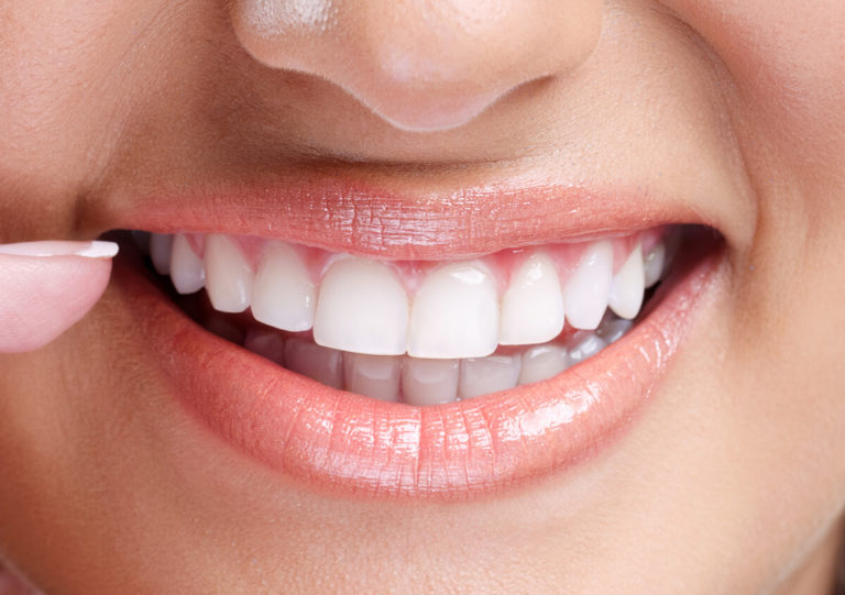FLAWED TEETH? TRANSFORM YOUR SMILE WITH COSMETIC DENTISTRY