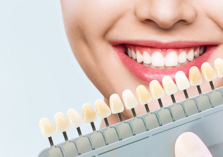 TRANSFORM YOUR SMILE WITH PORCELAIN VENEERS