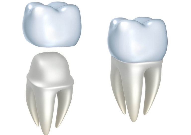 RESTORE YOUR SMILE WITH PORCELAIN DENTAL CROWNS