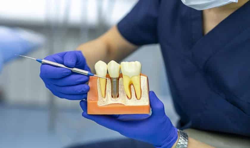 Dental Implants Richmond