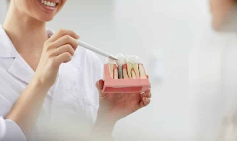 Fast, Safe, and Effective: The Benefits of Same-Day Dental Implants