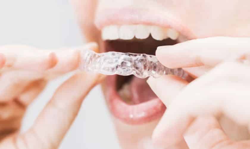 Invisalign Dentist