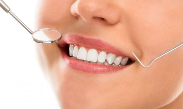 Whiten and Wow: Transform Your Smile with Teeth Whitening
