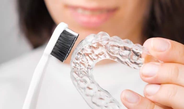 Achieve a Healthy Smile: Top Strategies for Oral Hygiene with Clear Aligners