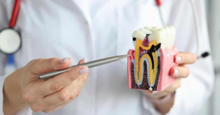 Root Canal Recovery: Your Complete Roadmap to a Healthy Smile