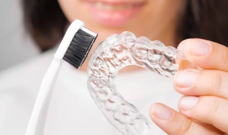 Clear Aligners Cleaning Hacks Every Beginner Should Know