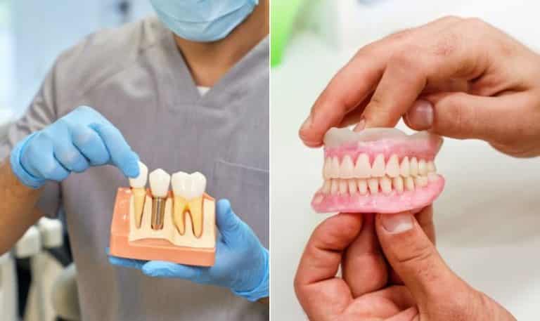 Dental Implants vs. Dentures: Which Is the Superior Option?