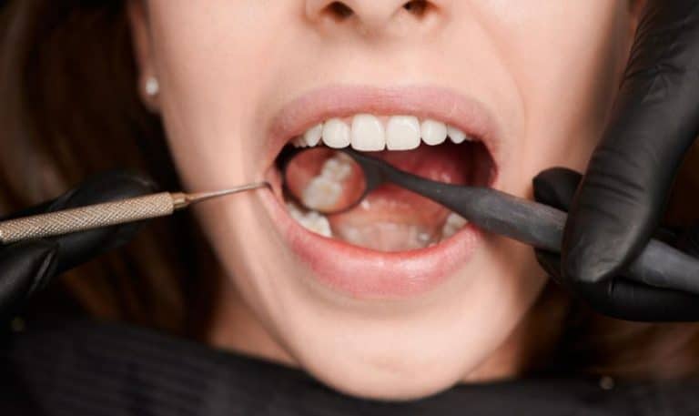 The Importance of Regular Dental Check-ups After Teeth Whitening in Northside Richmond, VA