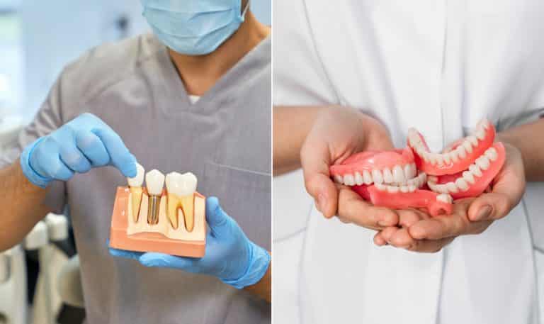 Comparing Dental Implants and Dentures: A Comprehensive Guide
