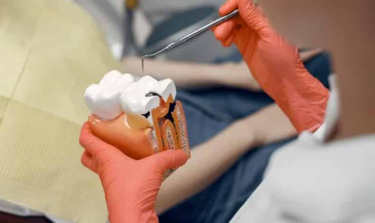 What To Do If A Root Canal Gets Infected: Your Comprehensive Guide