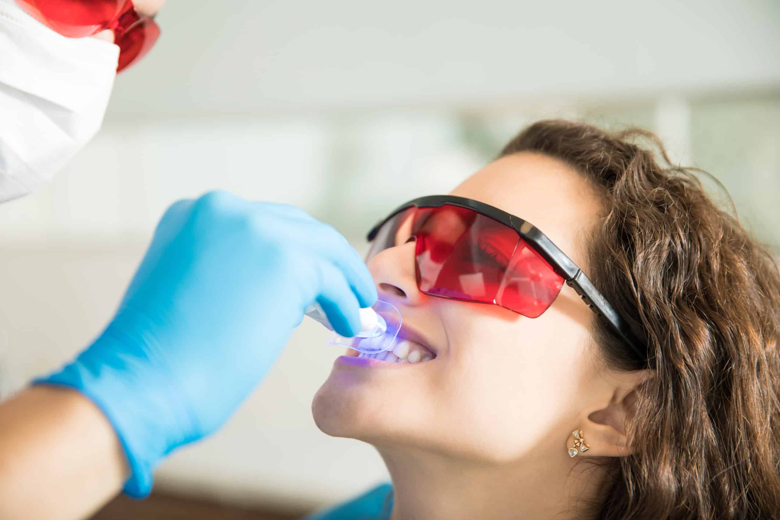 Teeth Whitening For Teenagers