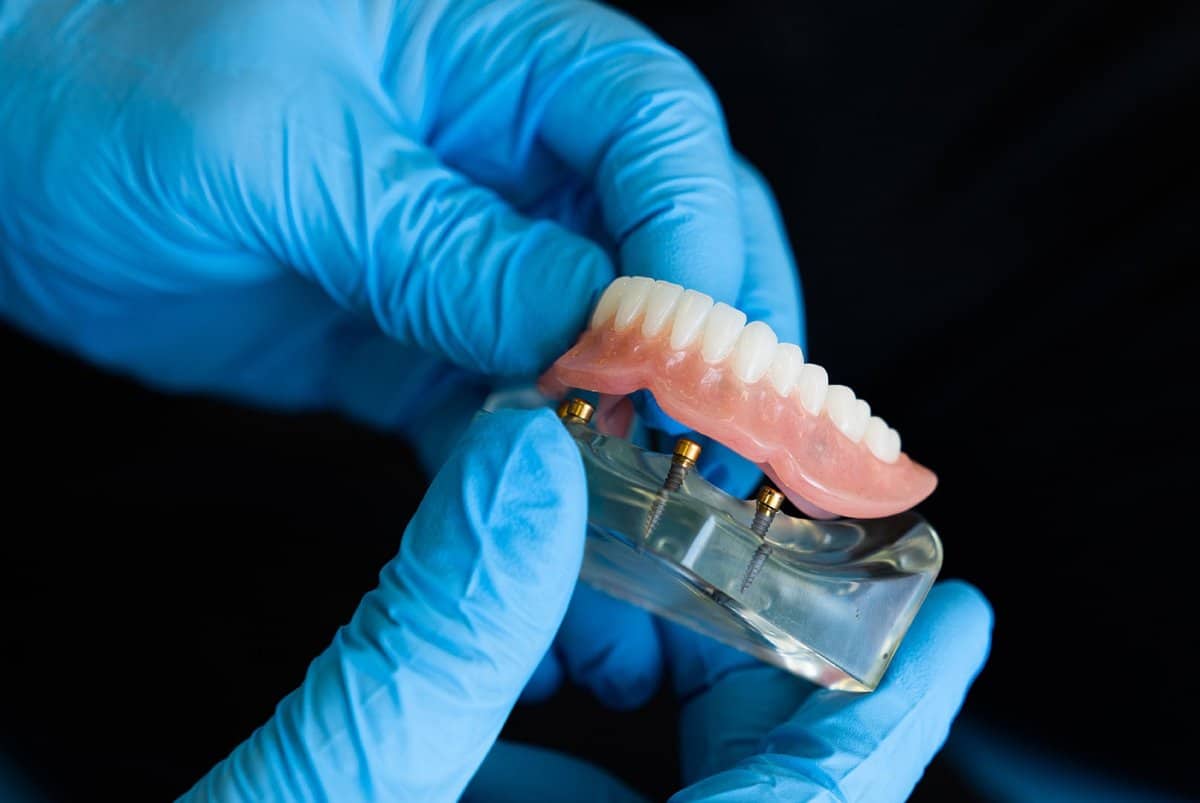 A Guide To Denture Repair Options