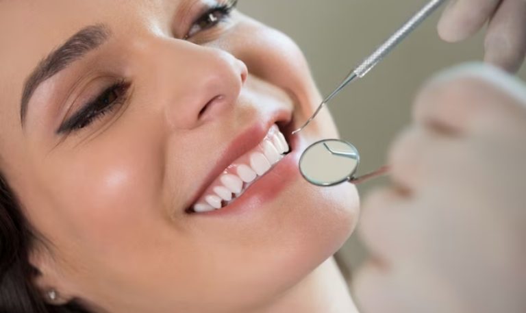 Professional Teeth Whitening: A Step-By-Step Process