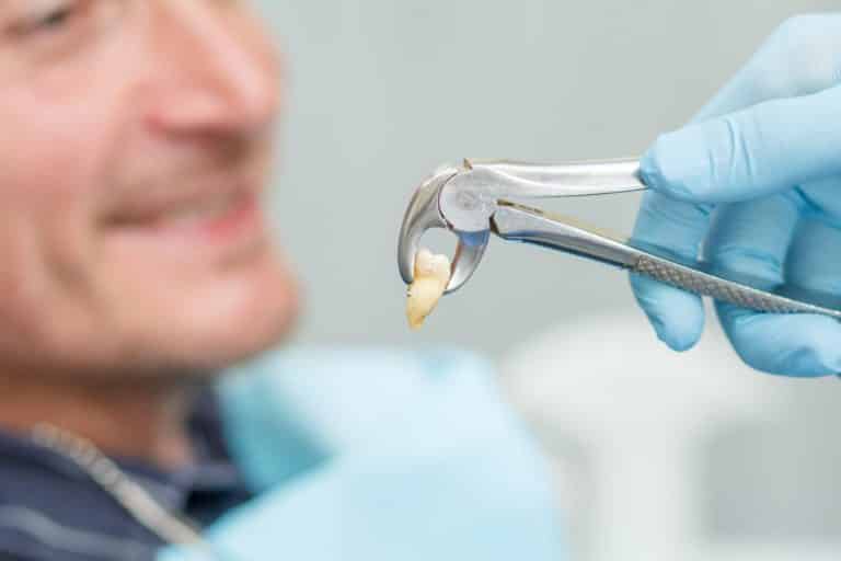 Tooth Extraction Bleeding: Know How To Stop It!