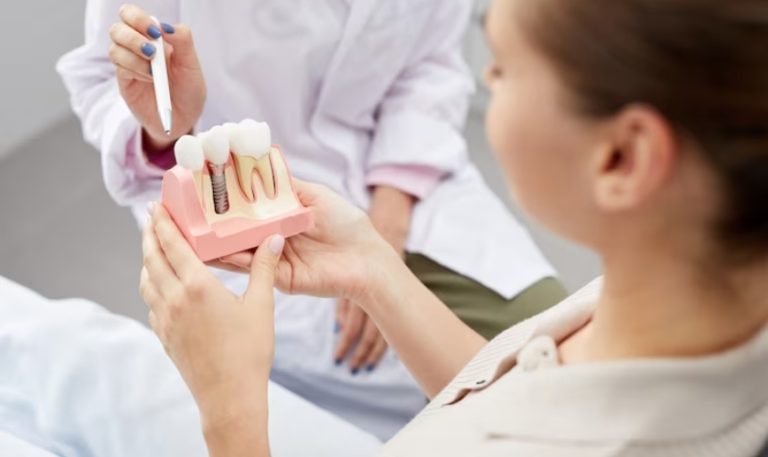 How To Care For Your Dental Implants: Tips And Tricks