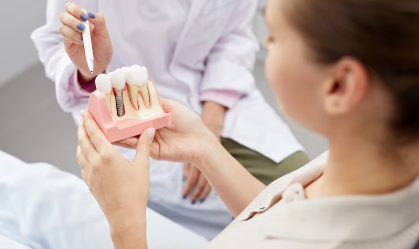 Care For Your Dental Implants