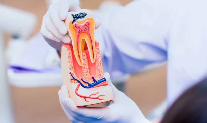 Mandatory Precautions You Must Take After Root Canal