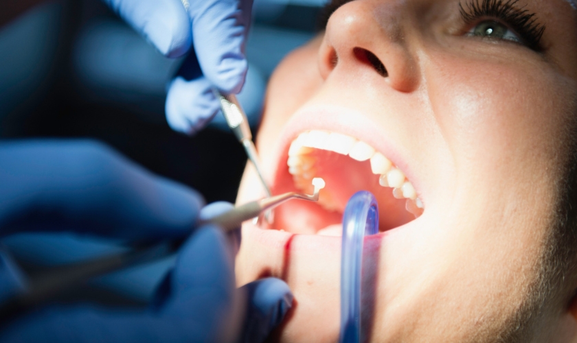 Post-Dental Filling Pain