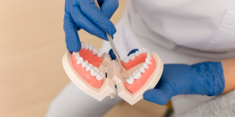 Caring for Your New Smile After Full Mouth Reconstruction
