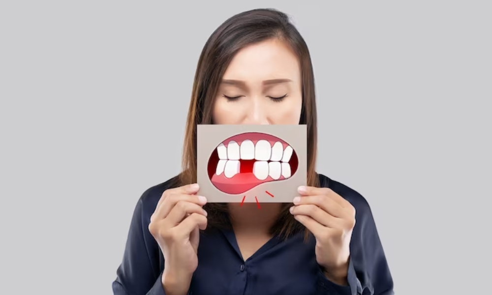 Major Issues Caused By Missing Teeth