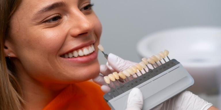 Are You a Candidate for Porcelain Veneers? Find Out Now