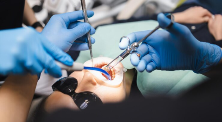 Which Tooth Extraction Is The Most Painful?