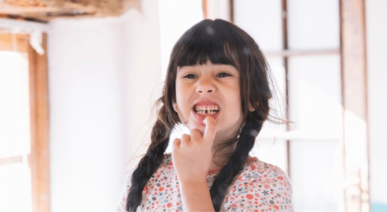 All You Need To Know About Your Child’s Dangling Tooth