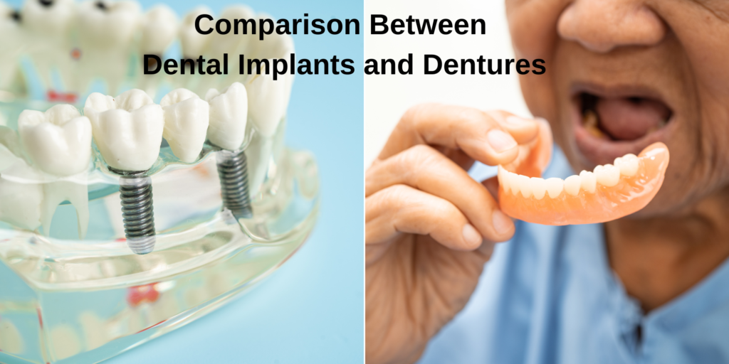 comparison dental implant and denture