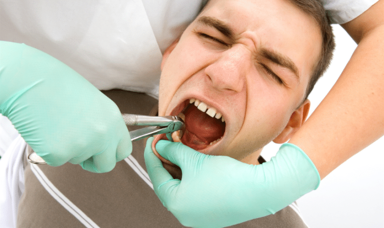 Bleeding After Tooth Extraction