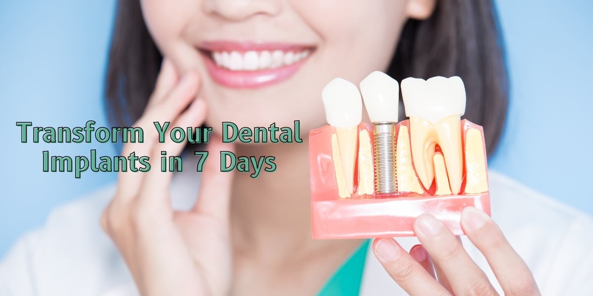 make your dental implants look amazing in 7 days