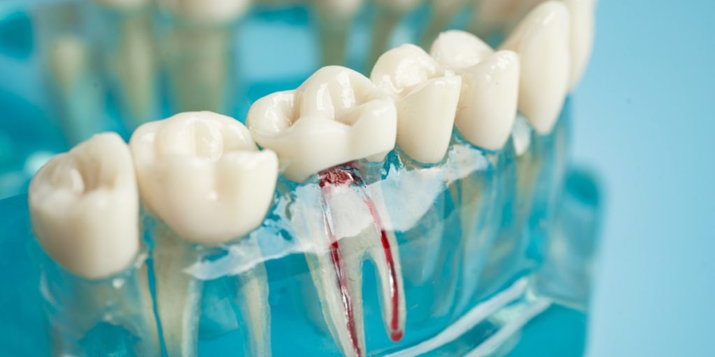 Why Root Canal Treatment Isn't as Scary as You Think