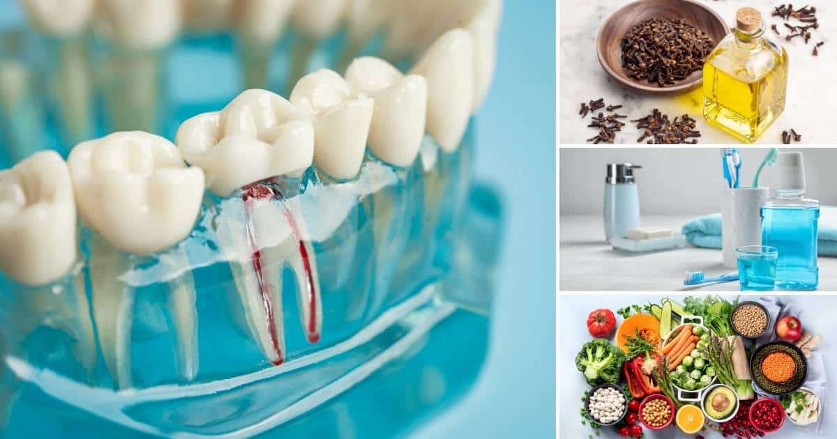 7 effective remedies for gum infection after root canal