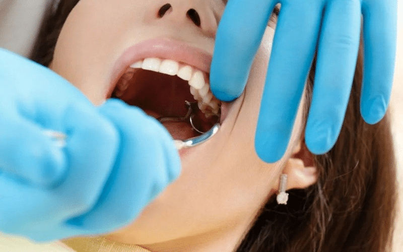 Common Reasons For Tooth Extractions