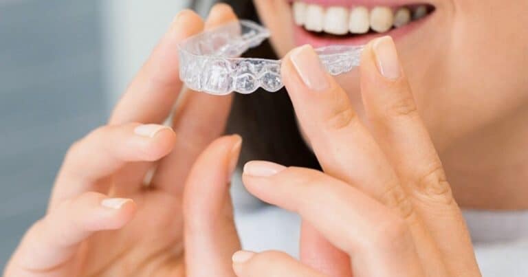 invisalign and underbites a perfect match for those who want a discreet treatment