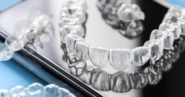 invisalign for your smile gaps