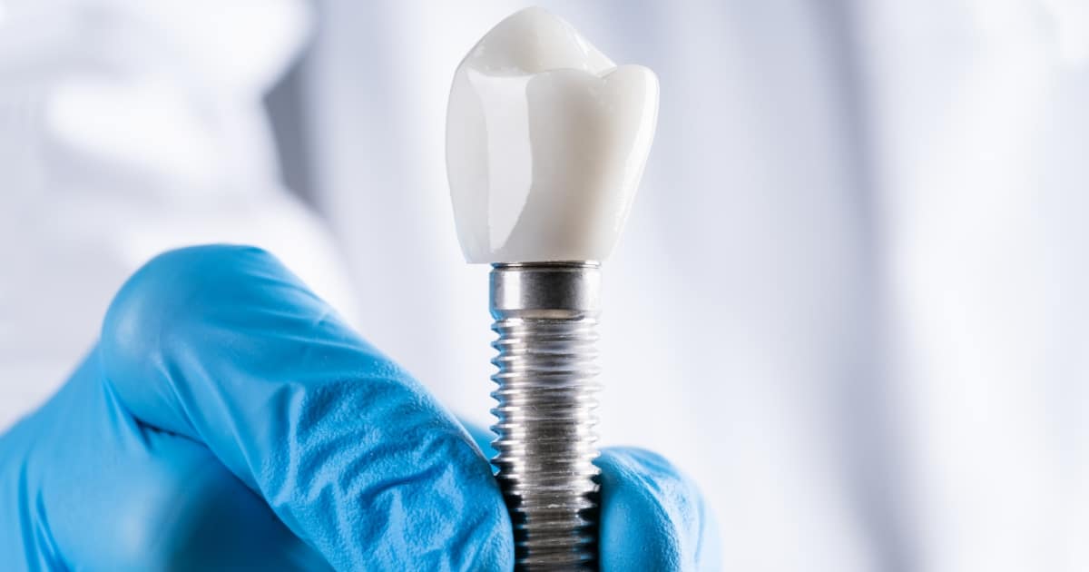 dental implants for seniors reclaim your smile at any age