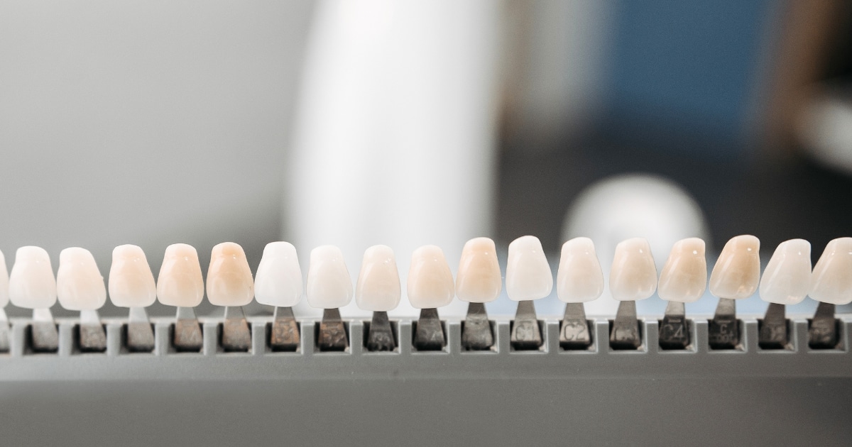 Porcelain Veneers 101 Pro Tips for Long-Lasting Care