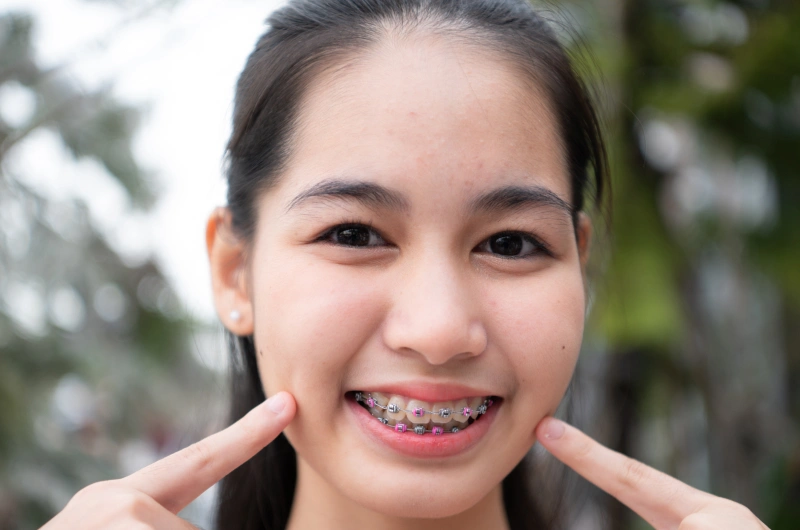 Orthodontics for Teens
