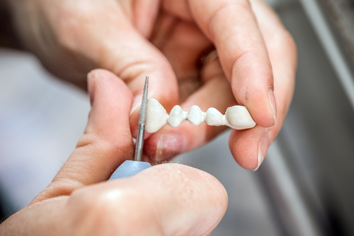 Featured image for “How Much of the Tooth Must Be Preserved for a Crown?”