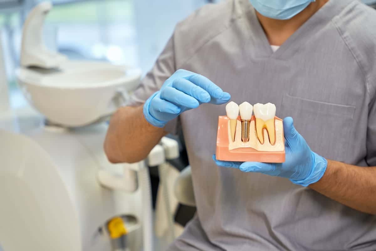 Featured image for “Dental Implants in Henrico, VA | Best Smiles Staples Mill”