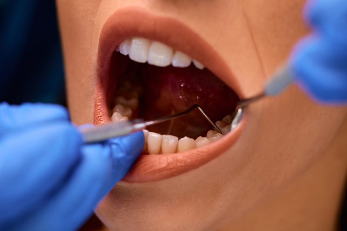Gum Disease Treatment in Laurel