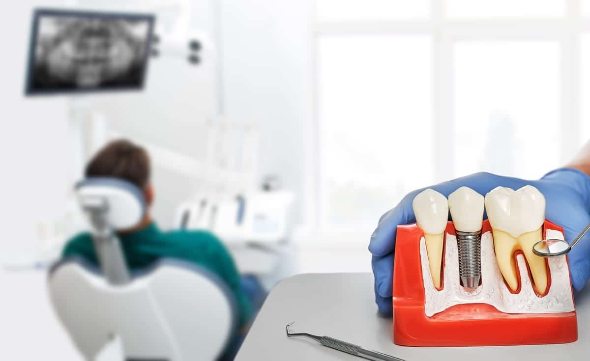 Featured image for “5 Questions About Dental Bridges Your Dentist Will Answer”